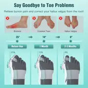 1pc Bunion Corrector For Women Men Big Toe, Adjustable Knob Bunion Splint For Bunion Relief, Orthopedic Toe Straightener With Anti-slip Heel Strap, Suitable For Left And Right Feet, Only Fit Night/home Use, Long-term Use And Replace Regularly